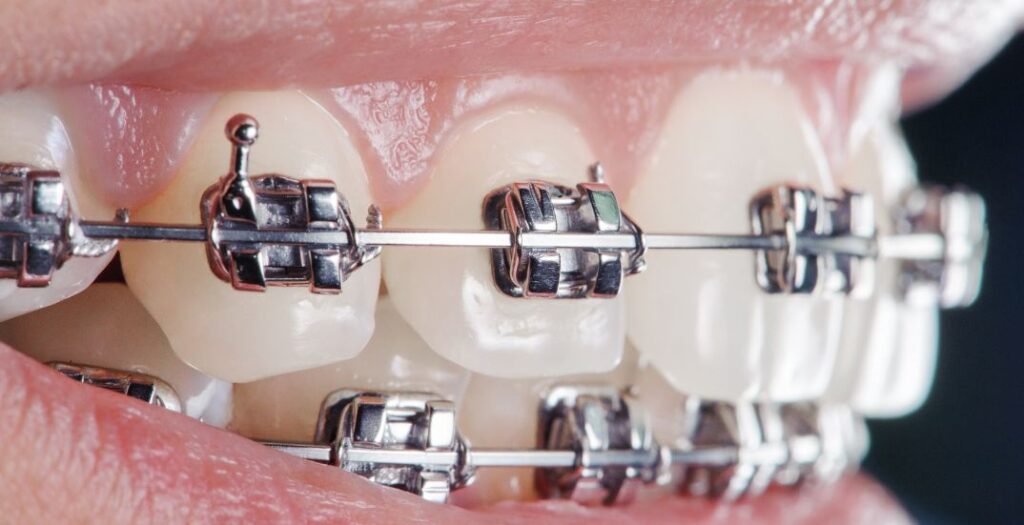 Orthodontic Evaluation