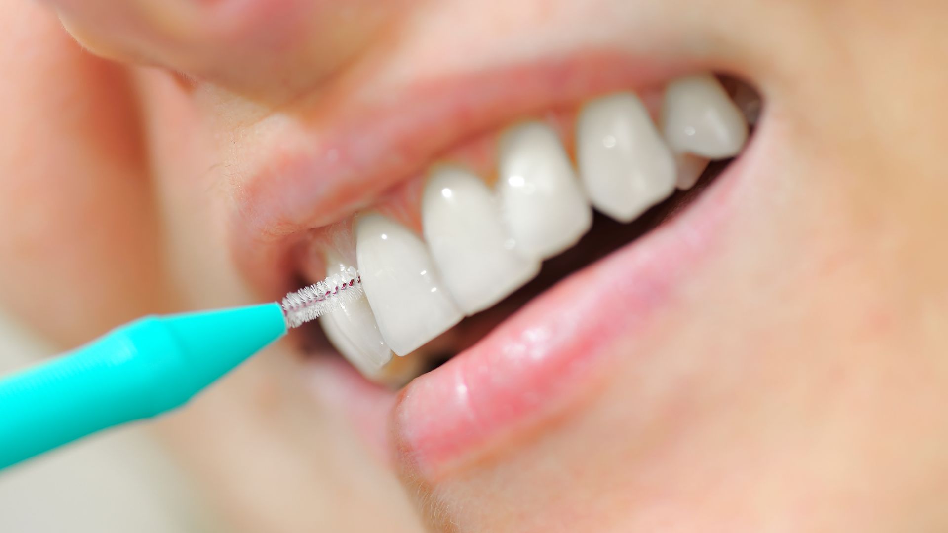 Effective Interdental Cleaning